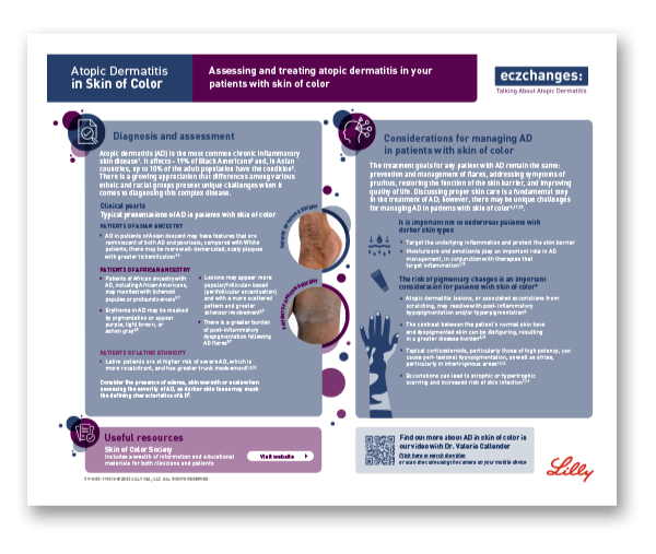 Atopic Dermatitis in Skin of Color infographic