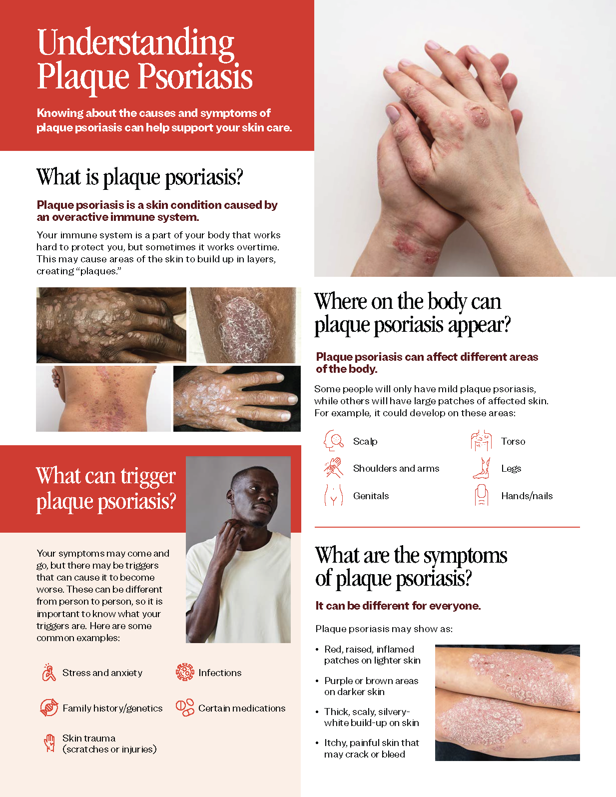 Understanding Plaque Psoriasis brochure