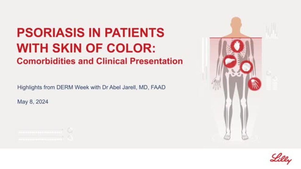 psoriasis in patients with skin of color video thumbnail